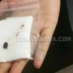 Sengketa IUP Telan Korban, Proyektil Peluru Berhasil Diangkat Sengketa IUP Telan Korban, Proyektil Peluru Berhasil Diangkat