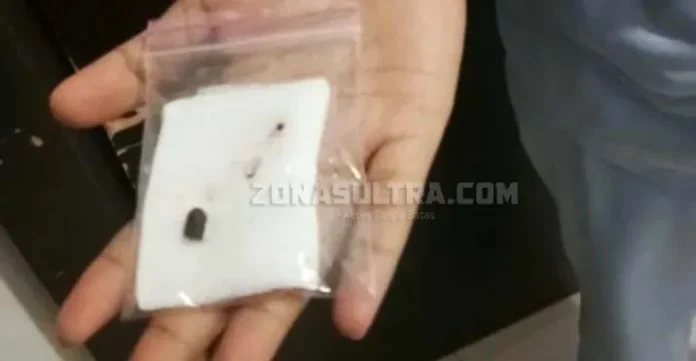 Sengketa IUP Telan Korban, Proyektil Peluru Berhasil Diangkat