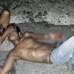 Usai Pesta Miras Bersama, Tangan Pria Asal Wakatobi Dipotong Temannya