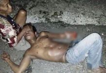 Usai Pesta Miras Bersama, Tangan Pria Asal Wakatobi Dipotong Temannya