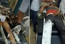 Ditabrak Mobil Truck, Kades di Konut Bersama Istri dan Anak Patah Tulang Ditabrak Mobil Truck, Kades di Konut Bersama Istri dan Anak Patah Tulang