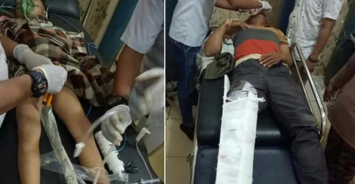 Ditabrak Mobil Truck, Kades di Konut Bersama Istri dan Anak Patah Tulang