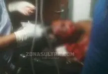 Pemuda di Muna Babak Belur Dipukuli Orang Bertopeng Pemuda di Muna Babak Belur Dipukuli Orang Bertopeng