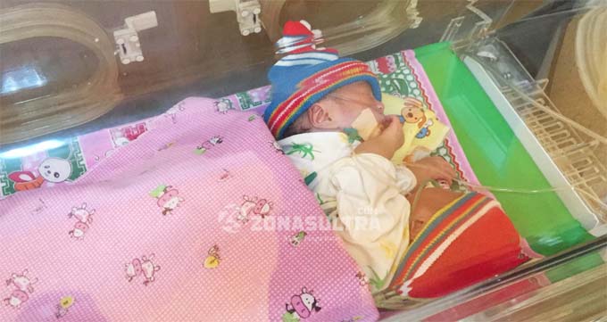 Bayi Kembar Siam di Kendari Butuh Bantuan Dana untuk Operasi