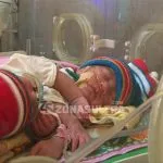 Bayi Kembar Siam di Kendari Butuh Bantuan Dana untuk Operasi Bayi Kembar Siam di Kendari Butuh Bantuan Dana untuk Operasi