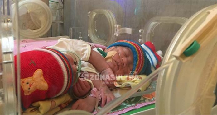 Bayi Kembar Siam di Kendari Butuh Bantuan Dana untuk Operasi