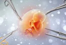 Diduga Aborsi di Kendari, Polres Muna Amankan Mahasiswa Asal Muna Barat ilustrasi aborsi