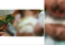 Lahir Tanpa Anus, Bayi Asal Koltim Dirawat di RSUD Bahteramas Lahir Tanpa Anus, Bayi Asal Koltim Dirawat di RSUD Bahteramas