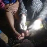 Korban Banjir Wanggu Luka Ringan dan Mulai Menderita Gatal-Gatal Korban Banjir Wanggu Luka Ringan dan Mulai Menderita Gatal-Gatal