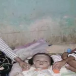 Perjuangan Balita Penderita Hidrosefalus Menantikan Keajaiban Perjuangan Balita Penderita Hidrosefalus Menantikan Keajaiban