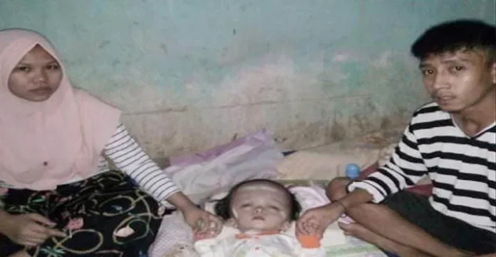 Perjuangan Balita Penderita Hidrosefalus Menantikan Keajaiban