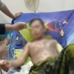 Siram Suaminya dengan Air Mendidih, Juniatin Diburu Polisi Sakit Hati, Seorang Istri di Konsel Tega Menyiram Suaminya dengan Air Mendidih