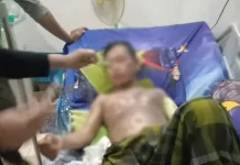 Siram Suaminya dengan Air Mendidih, Juniatin Diburu Polisi Sakit Hati, Seorang Istri di Konsel Tega Menyiram Suaminya dengan Air Mendidih