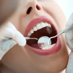 Jaga Keutuhan Gigi dengan Rutin Bersihkan Karang Gigi Jaga Keutuhan Gigi dengan Rutin Bersihkan Karang Gigi