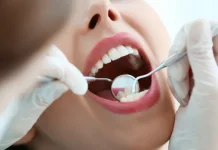 Jaga Keutuhan Gigi dengan Rutin Bersihkan Karang Gigi Jaga Keutuhan Gigi dengan Rutin Bersihkan Karang Gigi