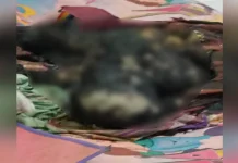 Ini Penyebab Terbakarnya Wanita Asal Bombana Ini Penyebab Terbakarnya Wanita Asal Bombana