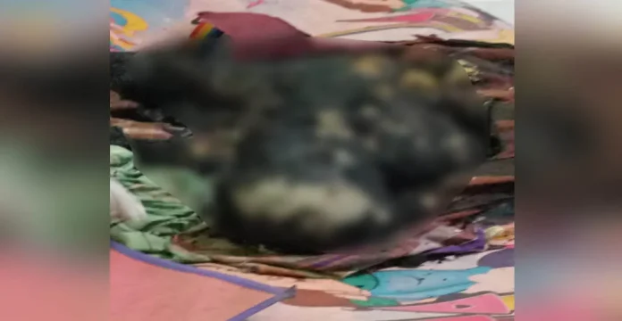 Ini Penyebab Terbakarnya Wanita Asal Bombana