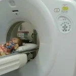 Bupati Mubar Bantu Bayi Penderita Hidrosefalus Bupati Mubar Bantu Bayi Penderita Hidrosefalus