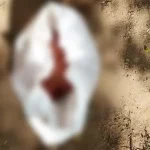 Ini Alasan Mahasiswa Buang Potongan Daging Payudara Potongan Payudara Ditemukan di Taman Kantor Gubernur