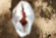 Ini Alasan Mahasiswa Buang Potongan Daging Payudara Potongan Payudara Ditemukan di Taman Kantor Gubernur