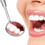 Cara Mudah Merawat Mulut Agar Bersih dan Tetap Sehat Ilustrasi Mulut Sehat