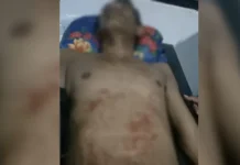 Pemuda Asal Kolaka Ini Dikeroyok dan Ditikam di Kabaena Pemuda Asal Kolaka Ini Dikeroyok dan Ditikam di Kabaena