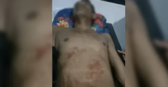 penikaman_kabaena Pemuda Asal Kolaka Ini Dikeroyok dan Ditikam di Kabaena