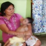 Gejala Gizi Buruk, Balita di Bombana Terbaring Kaku Gejala Gizi Buruk, Balita di Bombana Terbaring Kaku