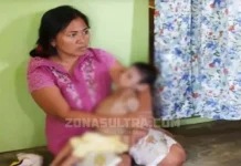 Gejala Gizi Buruk, Balita di Bombana Terbaring Kaku Gejala Gizi Buruk, Balita di Bombana Terbaring Kaku