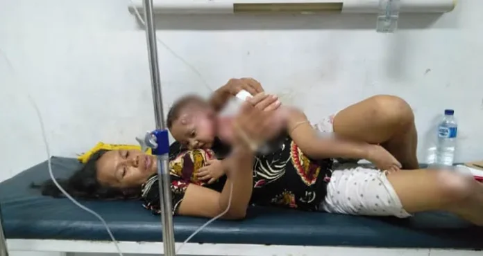 Kompor Meledak, Satu Keluarga di Muna Nyaris Terpanggang