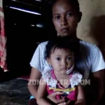 Duka Balita di Kolut Pasca Digigit Anjing Gila, Lukanya Sampai 100 Jahitan Serangan Anjing Gila Resahkan Warga Kolaka Utara