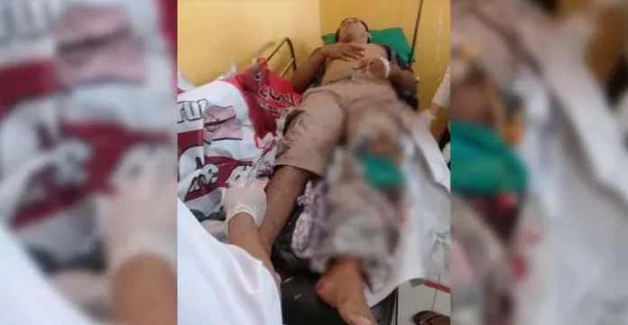 Cemburu, Seorang Pria di Konsel Parangi Teman Istrinya