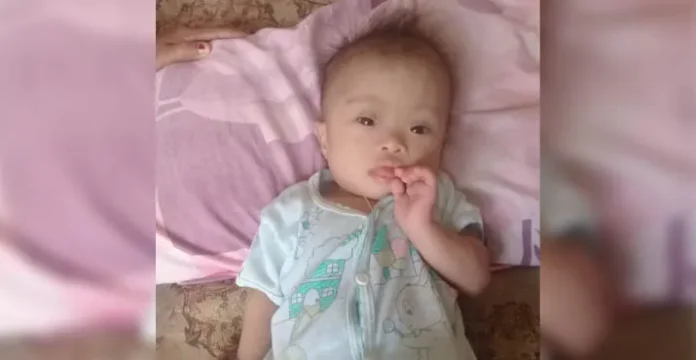 bayi_malang Balita Asal Konsel Tak Punya Lubang Anus yang Butuh Uluran Tangan