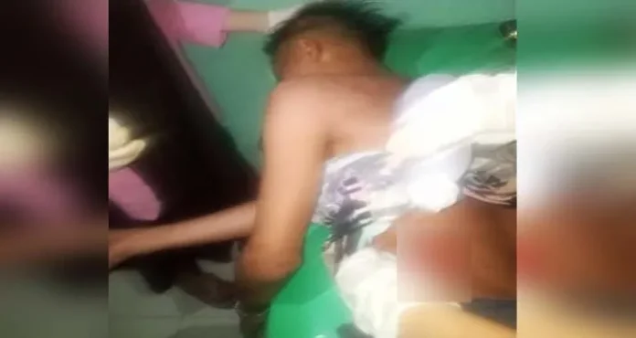 Tabrak Sapi, Pemuda Asal Konut Ini Alami Luka Robek di Kepala