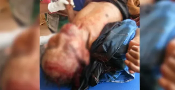 Lerai Pasutri Ribut, Pria di Muna Tewas Kena Tebas di Kepala