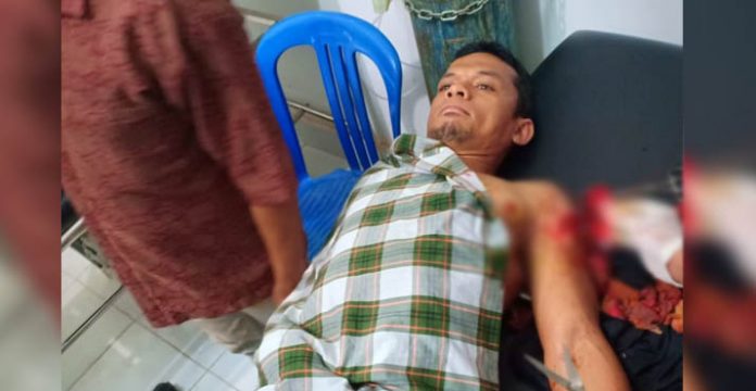 Tegur Pria Mabuk, Bapak Tiga Anak Malah Diparangi