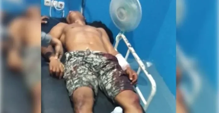 Tersinggung Saat Pesta Miras, Dua Warga Kolut Saling Bacok