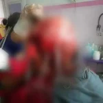 Rambut Terlilit Baling-baling Kapal, Kulit Kepala Remaja di Konut Terkelupas Rambut Terlilit Baling-baling Kapal, Kulit Kepala Remaja di Konut Terkelupas