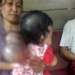 Alami Pembengkakkan Kepala, Seorang Bayi di Konsel Butuh Bantuan Alami Pembengkakkan Kepala, Seorang Bayi di Konsel Butuh Bantuan