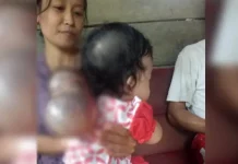 Alami Pembengkakkan Kepala, Seorang Bayi di Konsel Butuh Bantuan Alami Pembengkakkan Kepala, Seorang Bayi di Konsel Butuh Bantuan