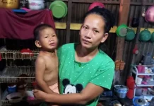 Bocah 2 Tahun di Kolut Diserang Anjing Gila Bocah 2 Tahun di Kolut Diserang Anjing Gila