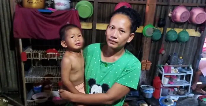 Bocah 2 Tahun di Kolut Diserang Anjing Gila