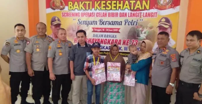 operasi_bibir_sumbing_polda_sulta_1 Senyum Merekah Para Pasien Bibir Sumbing Polda Sultra