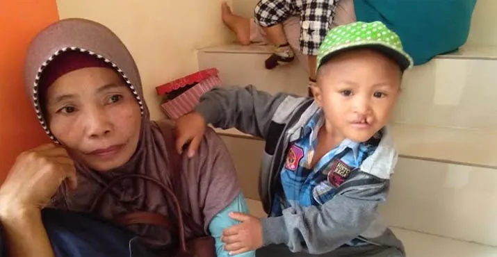 Senyum Merekah Para Pasien Bibir Sumbing Polda Sultra