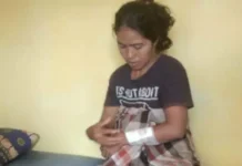 Sedang Mencuci di Sungai Tiworo, IRT di Mubar Digigit Buaya Sedang Mencuci di Sungai Tiworo, IRT di Mubar Digigit Buaya