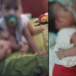 Kondisi Kian Membaik, Bayi Kembar Aqila Azila Akan Pulang Besok Kembar Siam di Kendari Aqila-Azila Tak Kunjung Dioperasi