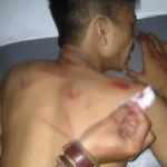 Ketua UK Seni UHO Terluka Dikeroyok di Bundaran Mandonga Ketua UK Seni UHO Terluka Dikeroyok di Bundaran Mandonga
