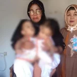 Bayi Kembar Siam Asal Kendari Ini Akan Dioperasi di Surabaya Bayi Kembar Siam Asal Kendari Ini Akan Dioperasi di Surabaya
