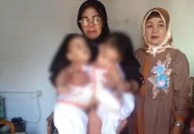 Pemkot Kendari Bakal Tanggung Biaya Bayi Kembar Ini Bayi Kembar Siam Asal Kendari Ini Akan Dioperasi di Surabaya