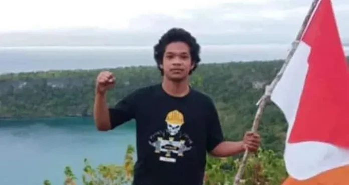 Sebelum Meninggal, Yusuf Kardawi Alami Pendarahan di Kepala